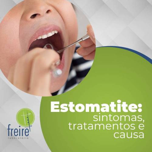 Estomatite: o que é, sintomas e tratamento