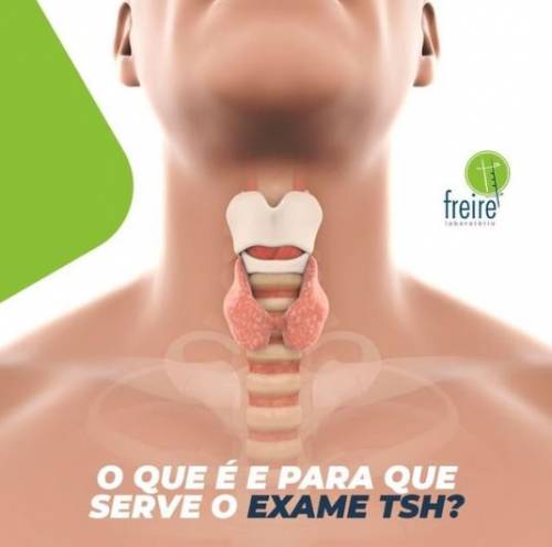 TSh: exame que pode indicar alterações na tireoide