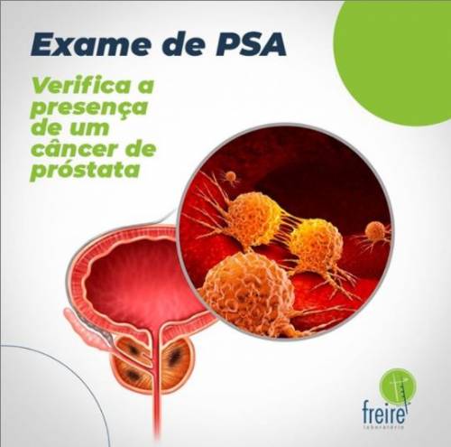 Exame PSA: Saiba Mais e Faça Agora